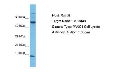 Western Blot: NMES1 Antibody [NBP1-98391]