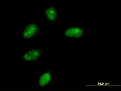 Immunocytochemistry/ Immunofluorescence: NMNAT-1 Antibody [H00064802-B01P]