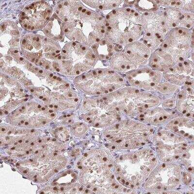 Immunohistochemistry-Paraffin: NMNAT-1 Antibody [NBP2-32464]