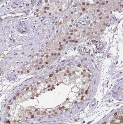 Immunohistochemistry-Paraffin: NMNAT-1 Antibody [NBP2-32464]