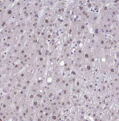 Immunohistochemistry-Paraffin: NMNAT-1 Antibody [NBP2-32464]