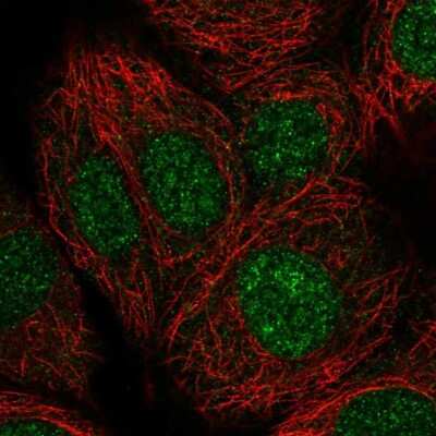 Immunocytochemistry/ Immunofluorescence: NMRAL1 Antibody [NBP1-83554]