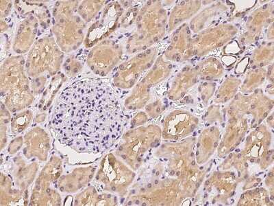 Immunohistochemistry-Paraffin: NMRAL1 Antibody [NBP3-06073]