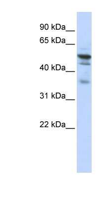 Western Blot: NMT1 Antibody [NBP1-54379]
