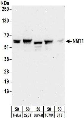 Western Blot: NMT1 Antibody [NBP2-32168]