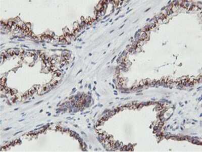 Immunohistochemistry-Paraffin: NMT2 Antibody (OTI1G3) [NBP2-01676]