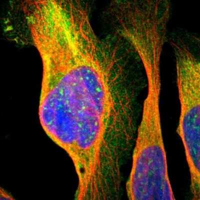Immunocytochemistry/ Immunofluorescence: NMT2 Antibody [NBP1-85817]