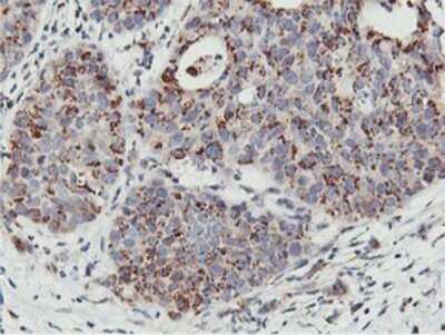 Immunohistochemistry: NMT2 Antibody (OTI1G3) - Azide and BSA Free [NBP2-73021]