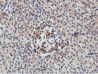 Immunohistochemistry: NMT2 Antibody (OTI1G3) - Azide and BSA Free [NBP2-73021]