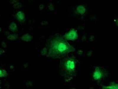 Immunocytochemistry/ Immunofluorescence: Nicotinamide N-Methyltransferase/NNMT Antibody (OTI3D8) [NBP2-00537]