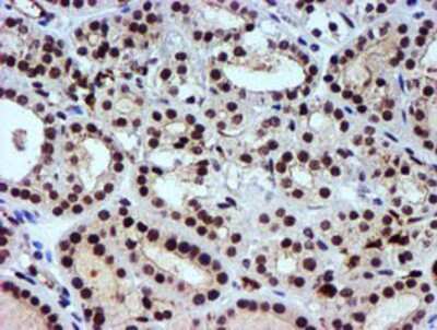 Immunohistochemistry-Paraffin: Nicotinamide N-Methyltransferase/NNMT Antibody (OTI3D8) [NBP2-00537]