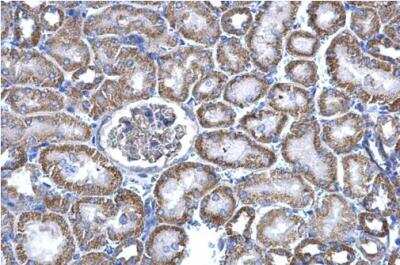 Immunohistochemistry-Paraffin: NNT Antibody [NBP1-32109]