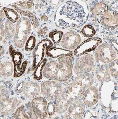 Immunohistochemistry-Paraffin: NNT Antibody [NBP1-86512]