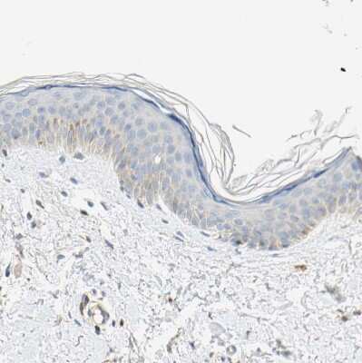 Immunohistochemistry-Paraffin: NNT Antibody [NBP1-86512]