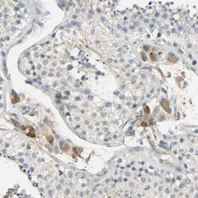 Immunohistochemistry-Paraffin: NNT Antibody [NBP1-86512]