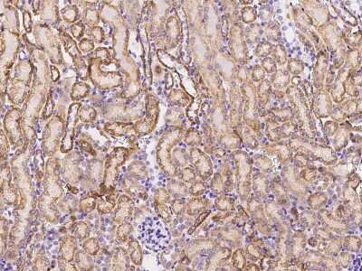Immunohistochemistry-Paraffin: NNT Antibody [NBP2-99302]