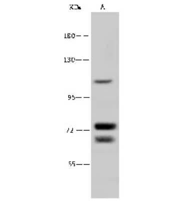Western Blot: NNT Antibody [NBP2-99302]