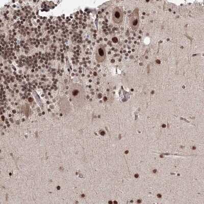 Immunohistochemistry-Paraffin: NOA1 Antibody [NBP1-81772]