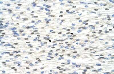 Immunohistochemistry: NOBOX Antibody [NBP2-84185]