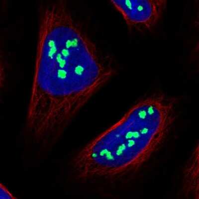 Immunocytochemistry/ Immunofluorescence: NOC2L Antibody [NBP1-92190]