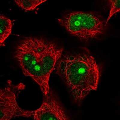 Immunocytochemistry/ Immunofluorescence: NOC4L Antibody [NBP2-55061]