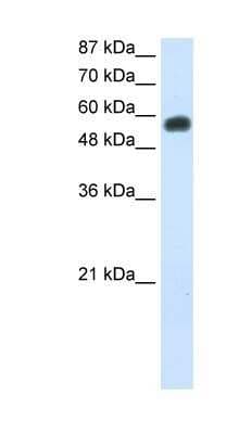Western Blot: NOC4L Antibody [NBP1-80464]