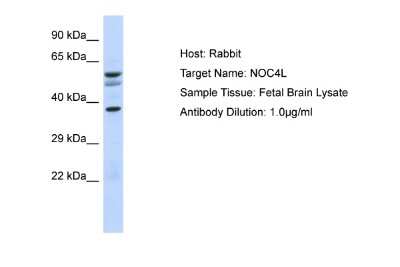Western Blot: NOC4L Antibody [NBP2-85389]