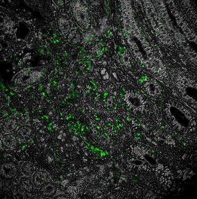 Immunohistochemistry-Frozen: NOD2 Antibody (2D9) - BSA Free [NB100-524]