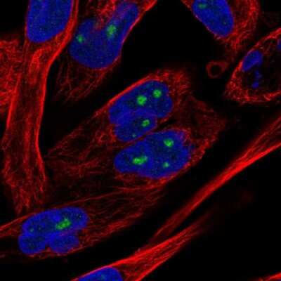 Immunocytochemistry/ Immunofluorescence: NOL10 Antibody [NBP2-55260]