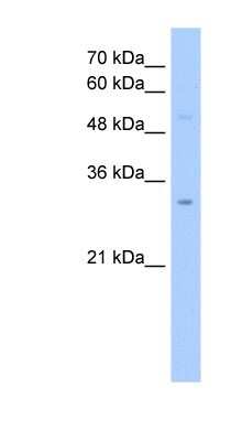 Western Blot: NOL1R2 Antibody [NBP1-70655]