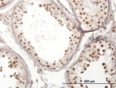 Immunohistochemistry-Paraffin: NOL4 Antibody (2A10) [H00008715-M01]