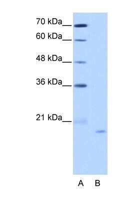 Western Blot: NOL6 Antibody [NBP1-57231]