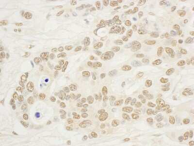 Immunohistochemistry: NOL8 Antibody [NBP1-46849]