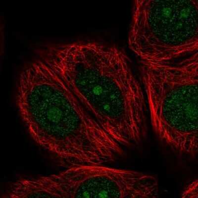Immunocytochemistry/ Immunofluorescence: NOM1 Antibody [NBP2-58765]