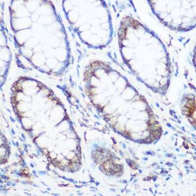 Immunohistochemistry-Paraffin: NOMO1 Antibody - BSA Free [NBP2-94166]