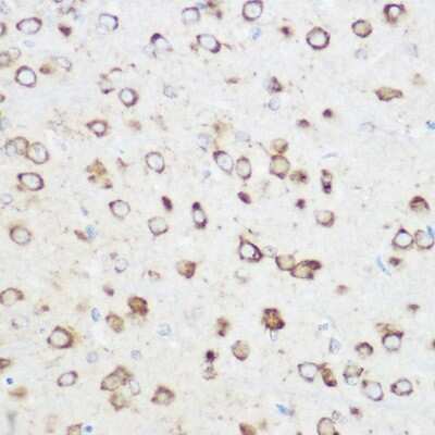 Immunohistochemistry-Paraffin: NOMO1 Antibody - BSA Free [NBP2-94166]