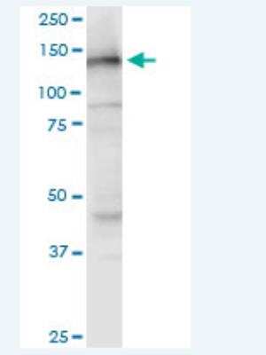 Western Blot: NOMO3 Antibody (5A7) [H00408050-M03-100ug]