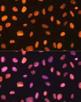 Immunocytochemistry/ Immunofluorescence: NONO Antibody (0V0N8) [NBP3-16276]