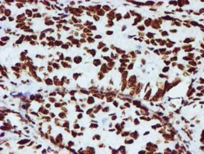 Immunohistochemistry-Paraffin: NONO Antibody (OTI4D9) [NBP2-02060]