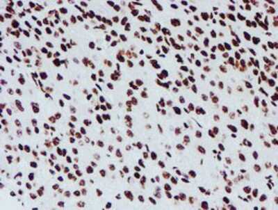 Immunohistochemistry-Paraffin: NONO Antibody (OTI4D9) [NBP2-02060]