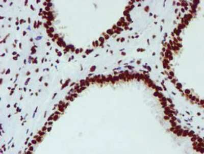 Immunohistochemistry-Paraffin: NONO Antibody (OTI4D9) [NBP2-02060]