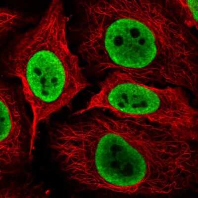 Immunocytochemistry/ Immunofluorescence: NONO Antibody [NBP2-38727]