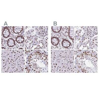 Immunohistochemistry-Paraffin: NONO Antibody [NBP2-38727]