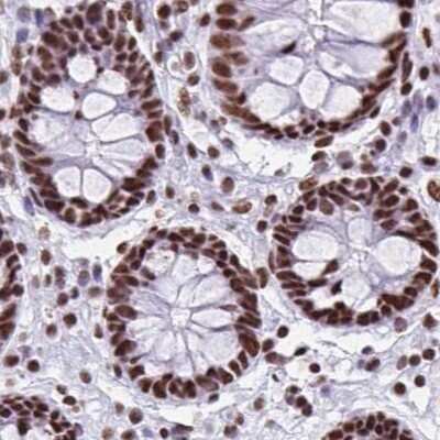 Immunohistochemistry-Paraffin: NONO Antibody [NBP2-38727]