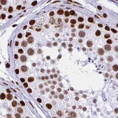 Immunohistochemistry-Paraffin: NONO Antibody [NBP2-38727]