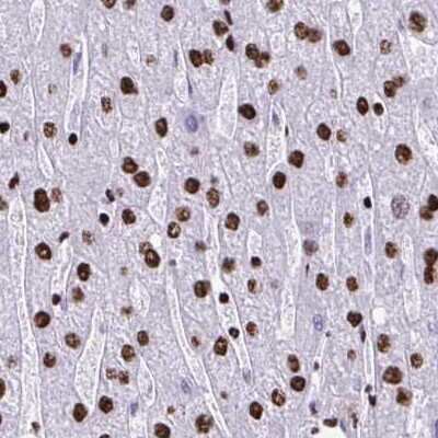 Immunohistochemistry-Paraffin: NONO Antibody [NBP2-38727]