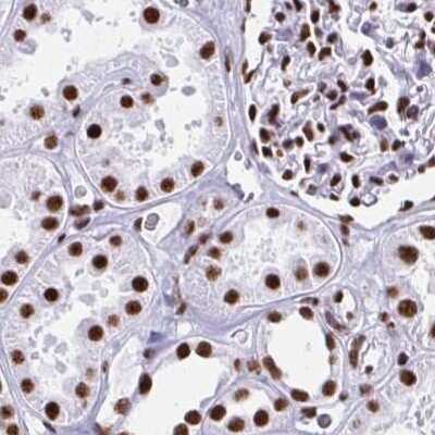Immunohistochemistry-Paraffin: NONO Antibody [NBP2-38727]