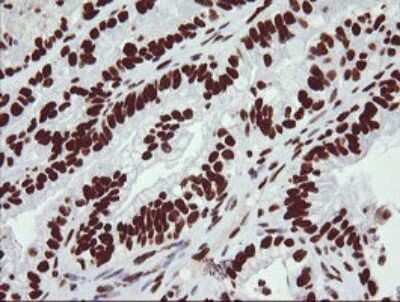 Immunohistochemistry: NONO Antibody (OTI3F8) [NBP2-46194]