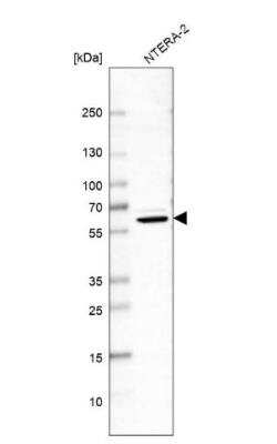 Western Blot: NONO Antibody [NBP2-38727]