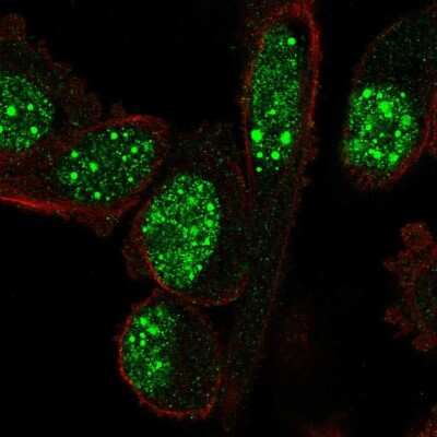 Immunocytochemistry/ Immunofluorescence: NOP10 Antibody [NBP2-32441]